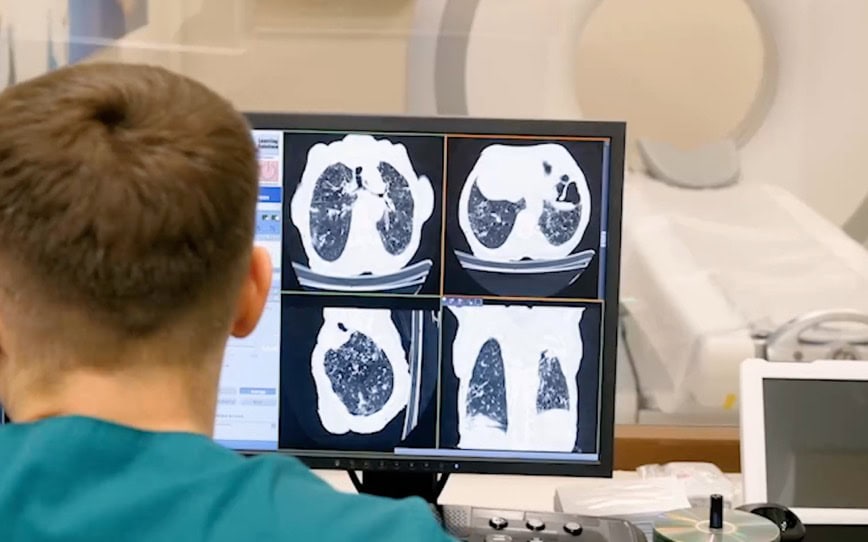 Cover Image for 4DMedical wins contract to supply lung imaging technology to US radiology company
