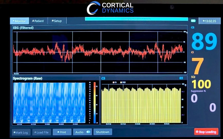Cover Image for BPH Energy-backed Cortical Dynamics unveils AI-driven neurotechnology innovations