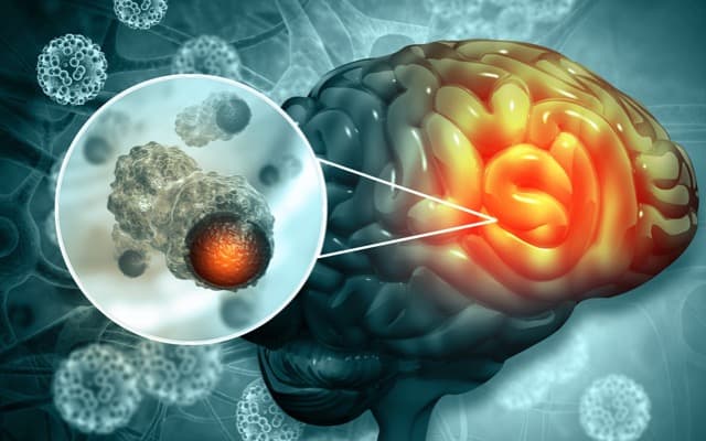 Cover Image for Chimeric Therapeutics receives ethics approval for phase 1B study in patients with brain cancer