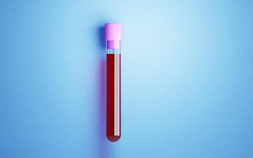 Cover Image for Cleo Diagnostics IPO raises $12 million to develop early-stage detection blood test for ovarian cancer