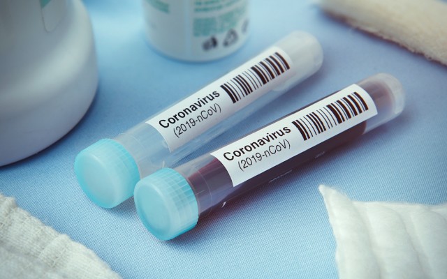 Coronavirus ASX stocks companies shares