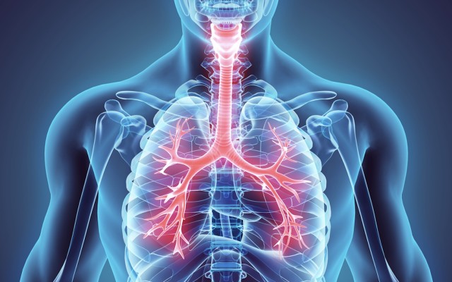 Cover Image for Cyclopharm set to take the fight against asthma to the next level via Technegas