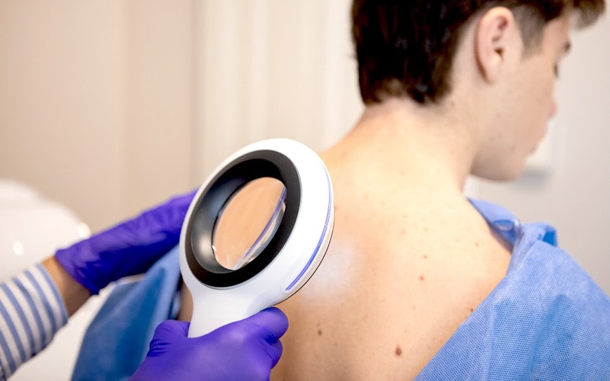 Cover Image for Invion commences dosing in INV043 trial to treat non-melanoma skin cancer