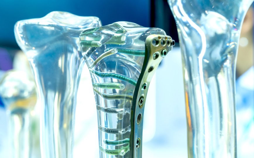 Cover Image for Osteopore granted European market approval for custom orthopaedic and cranial implants